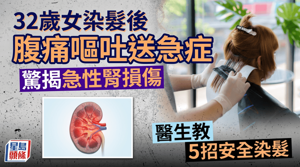  32歲女染髮後腹痛嘔吐送急症 驚揭急性腎損傷 醫生教5招安全染髮