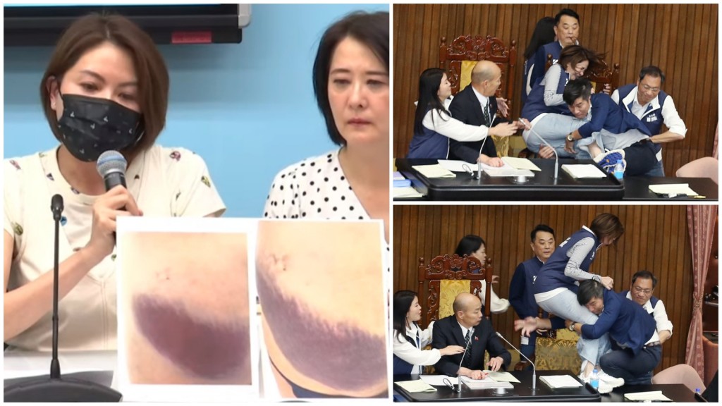 女議員陳菁徽（左）在記者會上公開照片，指受傷不輕。　台灣中時新聞網