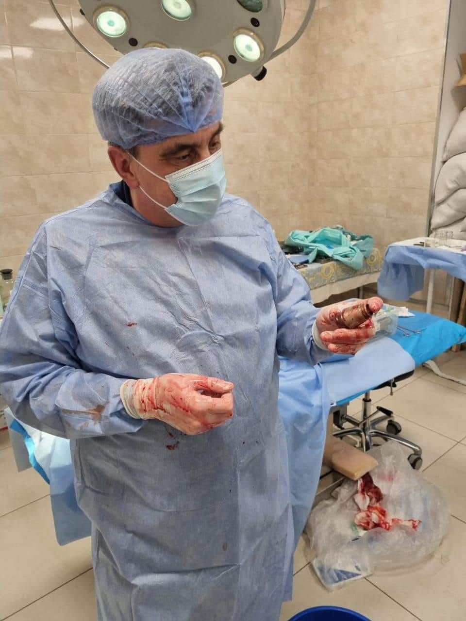 手術結束後，醫師還用手拿著榴彈。