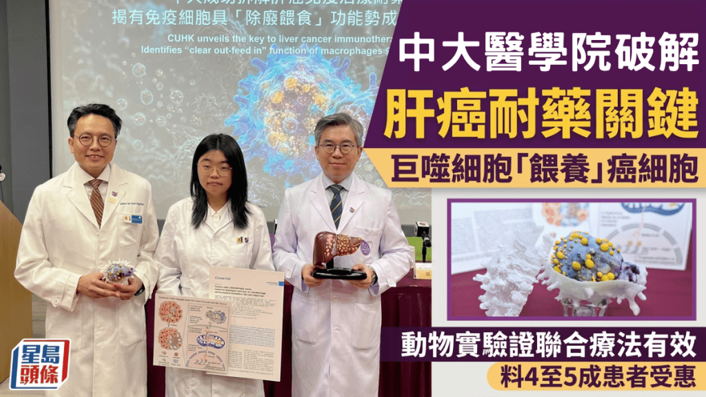 中大醫學院破解肝癌耐藥關鍵：巨噬細胞「餵養」癌細胞   動物實驗證聯合療法有效  料4至5成患者受惠