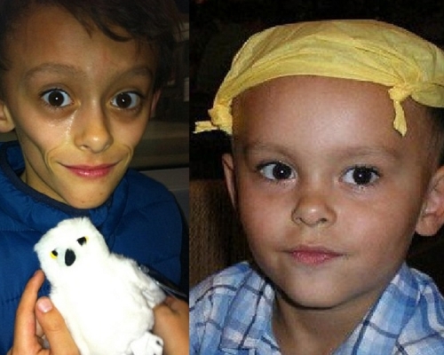 男童变得很瘦和脆弱不堪，甚至无力支撑起他的骨架。