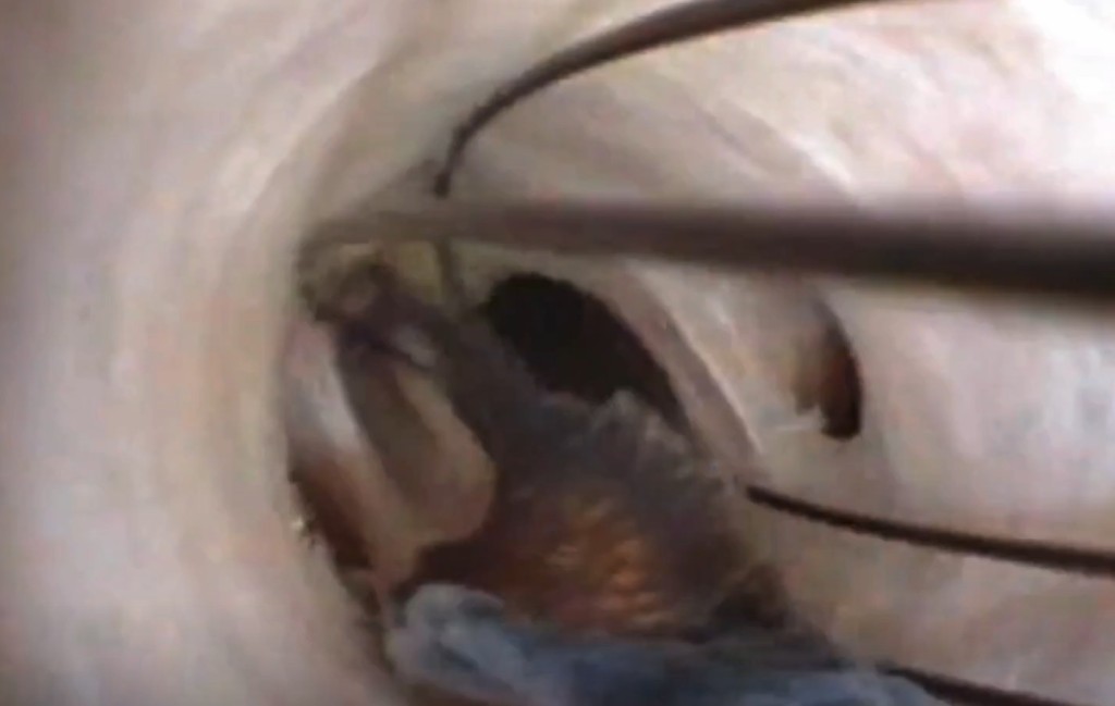 並處理治療寄生蟲的藥物(圖片來源:新英格蘭醫學期刊)