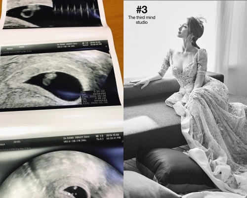 自爆陀B本月嫁圈外男友，T-ara前成員雅琳晒谷胸婚照。IG
