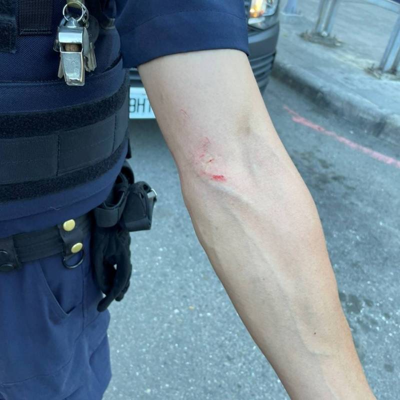 警員手臂受傷。