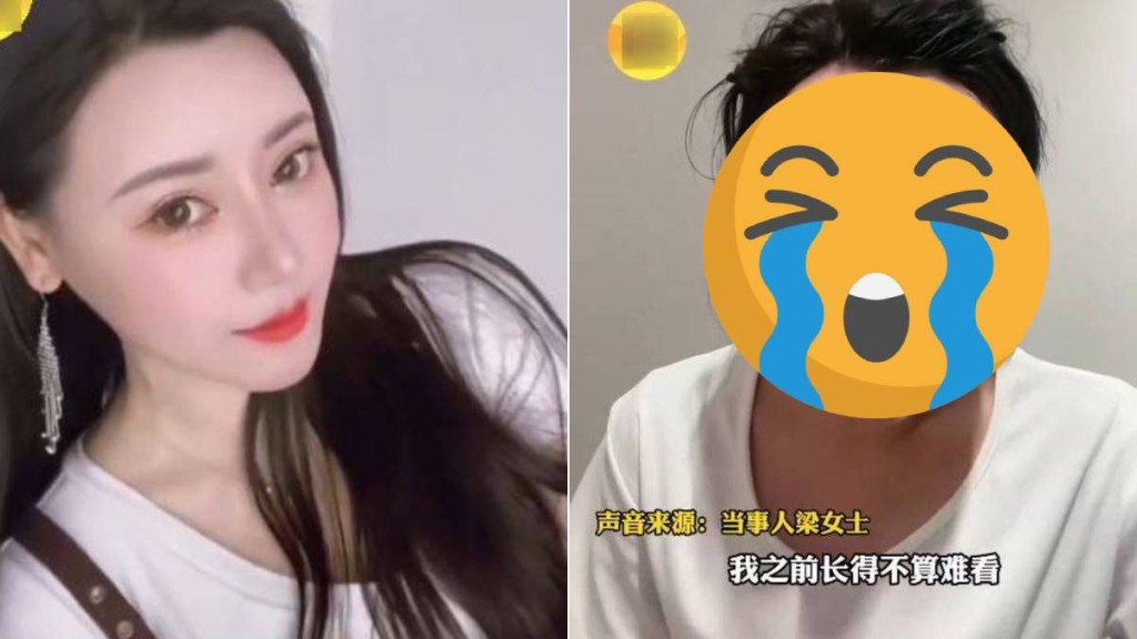 湖北的梁女士因在臉部注射生長因子變成面具人。起點新聞