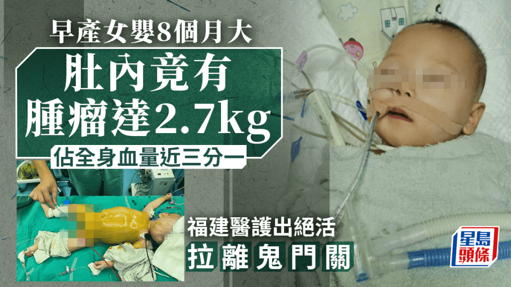 妙妙曾因肚內有一個巨大腫瘤而命懸一線。