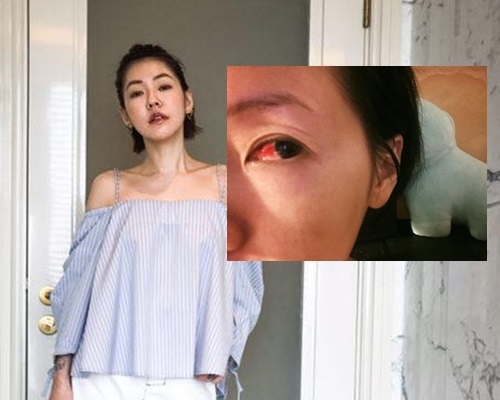 小S搽睫毛增長液搽出禍。