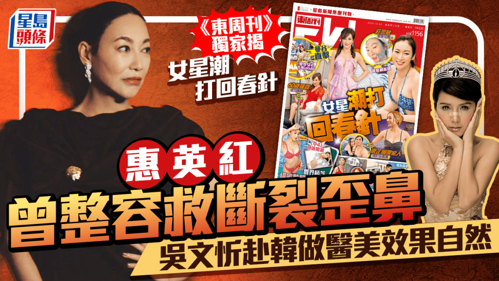 《東周刊》獨家直擊羅霖打針回春 惠英紅曾整容救斷裂歪鼻 吳文忻赴韓做醫美效果自然