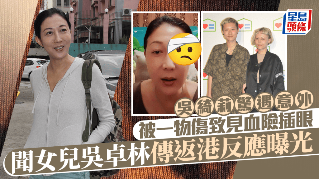 吳綺莉遇意外展示傷勢  被一物傷致見血險直插眼球  聞女兒吳卓林返港傳聞反應曝光