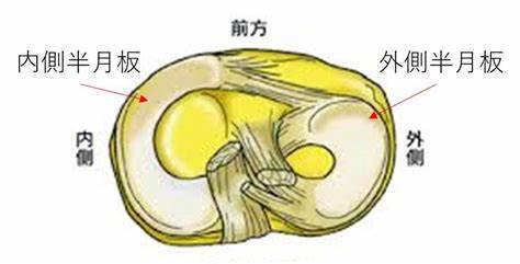 半月板受伤是运动员常见现象。 