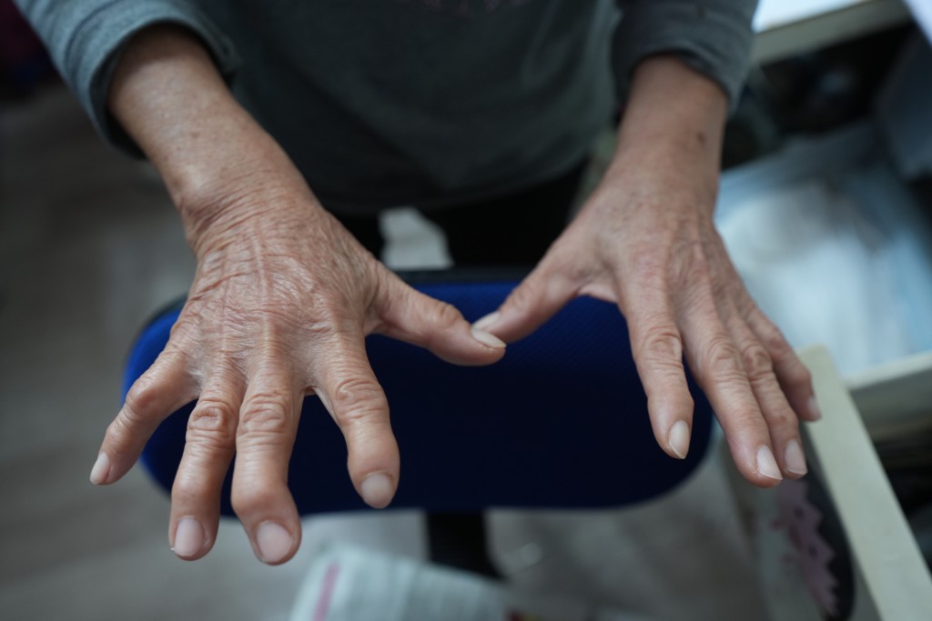 70歲的梁婆婆疫情下在私人屋苑做清潔工。長年累月搬垃圾袋，雙手手指弄至變形。