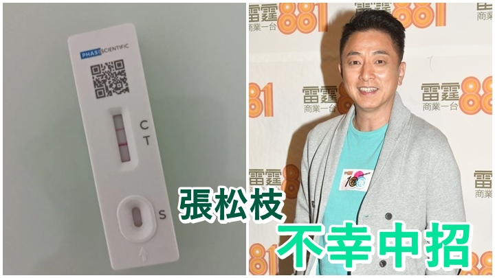 張松枝今日在社交網透露自己中招。