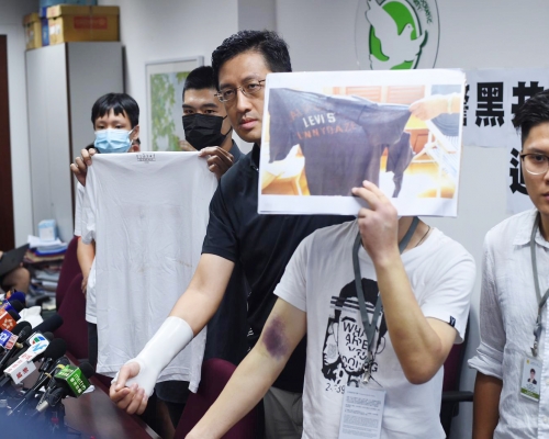 立法會議員林卓廷,聯同數名傷者與目擊者見傳媒。