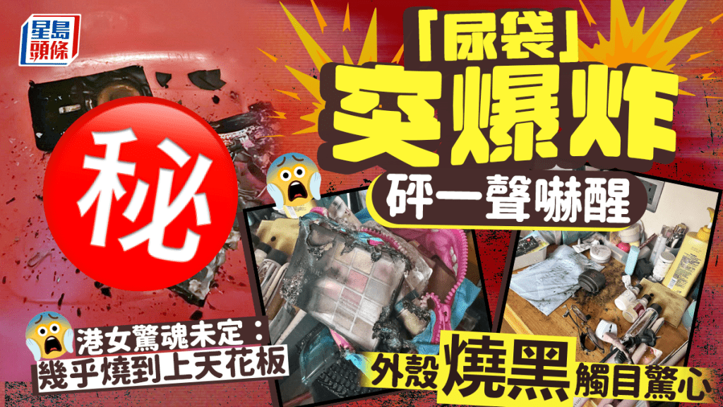 「尿袋」突爆炸砰一聲嚇醒 港女驚魂未定：幾乎燒到上天花板 外殼燒黑觸目驚心