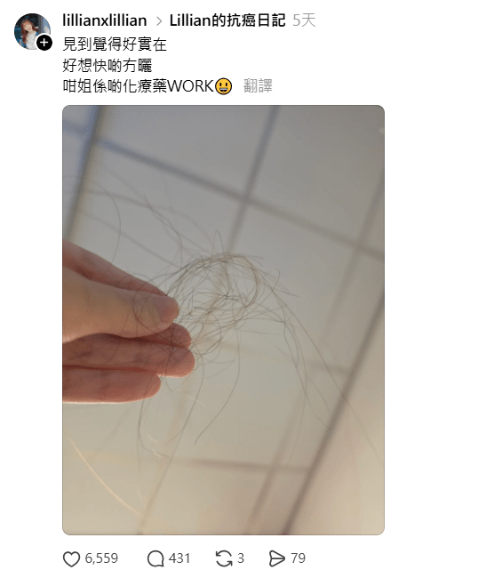 施可瑩化療副作用大，出現脫髮情況。