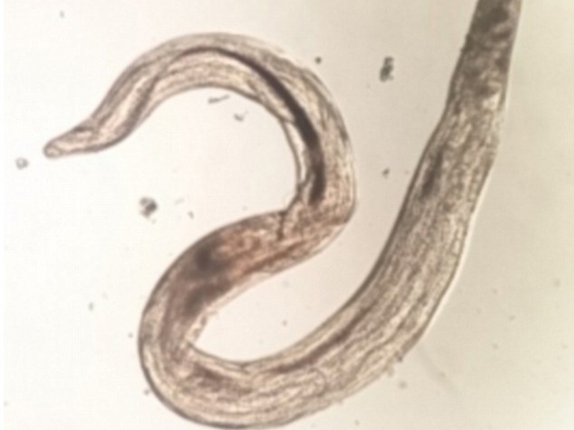 羅阿羅阿絲蟲（Loa loa）又稱眼絲蟲，是一種寄生蟲，分佈於非洲和印度熱帶地區。 網圖