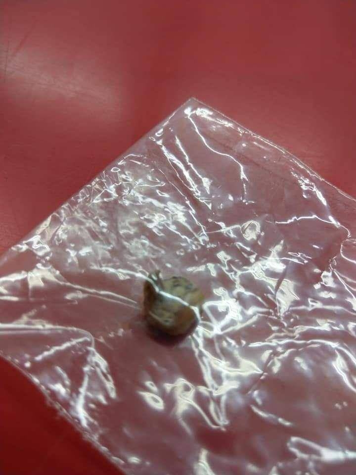 網民附上蛀牙的圖片，網民直呼：「太噁心」。FB圖