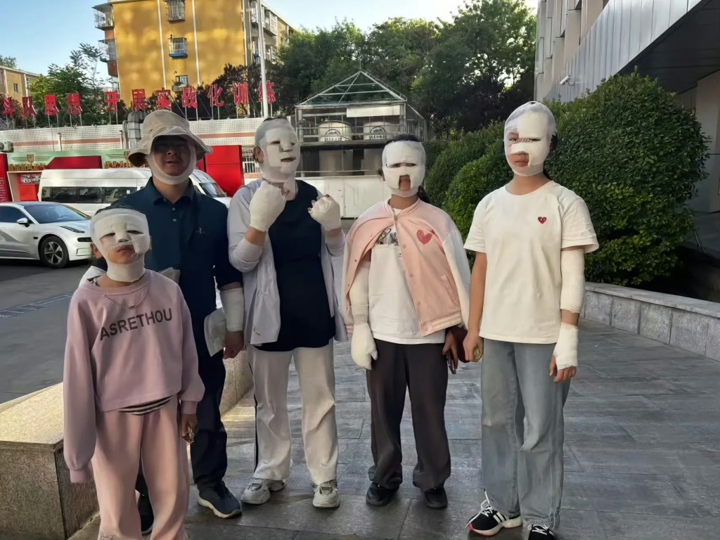 野外燒烤遇卡式爐爆炸多人被炸傷。微博@交通事兒 野外燒烤遇卡式爐爆炸多人被炸傷。微博@交通事兒