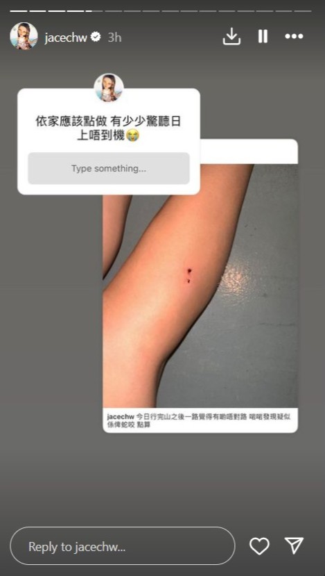 陈凯咏于限时动态与网民“你问我答”，看来并不紧张伤口。