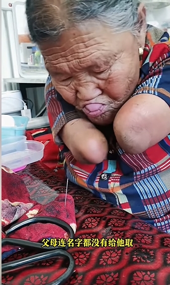 王玉氏用胳膊及嘴巴肘缝东西。