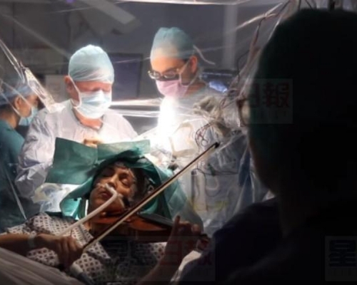 英国国王学院医院一名病人，日前一边进行开颅脑瘤移除手术，一边用小提琴演奏马勒和盖希文的音乐，好确保手术没有伤到左手细部动作区域。