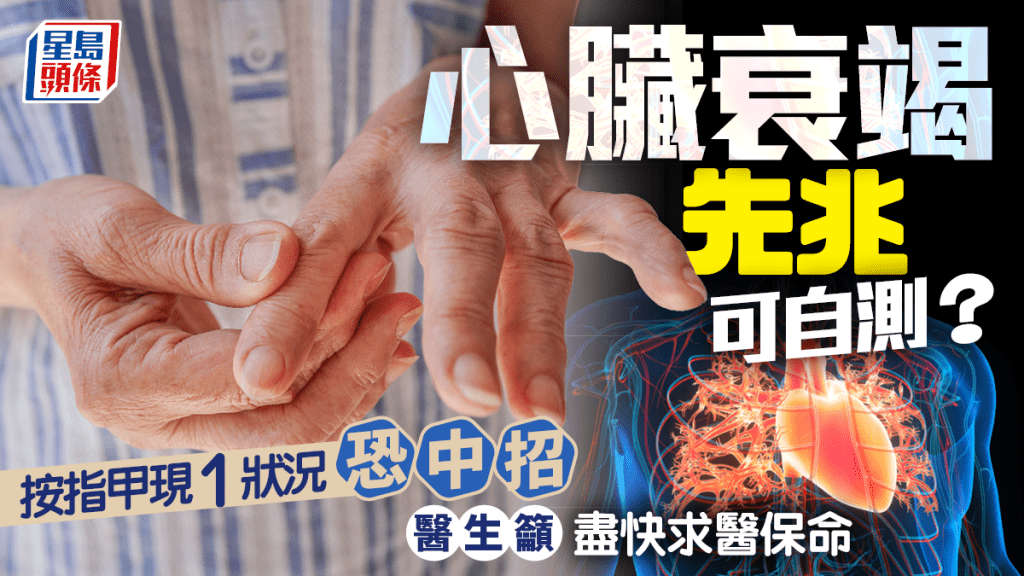心臟衰竭先兆可自測？按指甲現1狀況恐中招 醫生籲盡快求醫保命