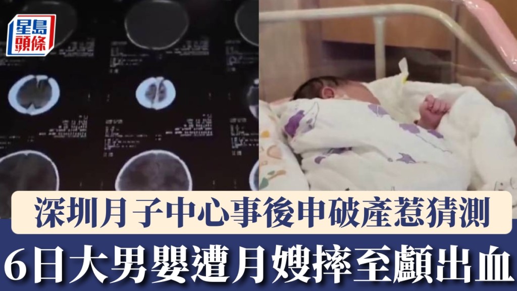 深圳6日大男嬰遭月嫂摔至顱出血，家屬索賠後月子中心隨即申請破產。