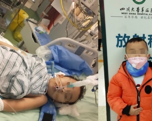 剴剴目前仍留醫深切治療部。