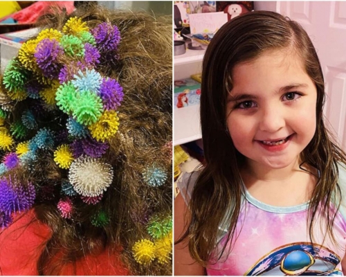 6歲女亂髮纏150個黏貼球，媽媽奮鬥20個小時復原。(網圖)