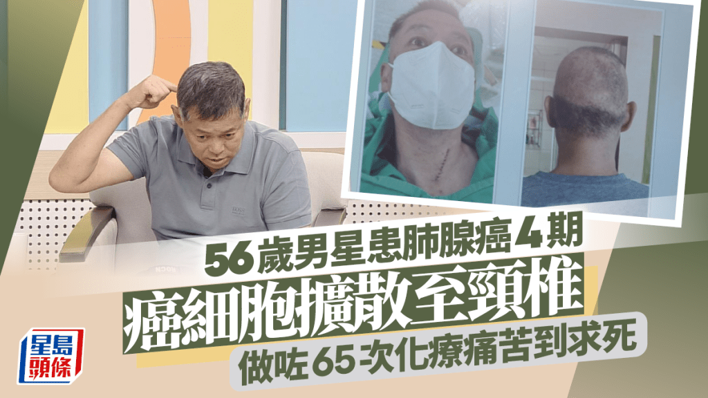 56歲男星患肺腺癌4期！癌細胞擴散到頸椎做咗65次化療 向上天喊話：拜託把我帶走