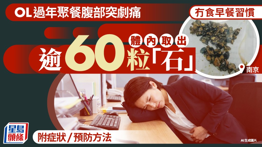 南京OL慣性不吃早餐，體內「藏」60多粒膽囊結石。