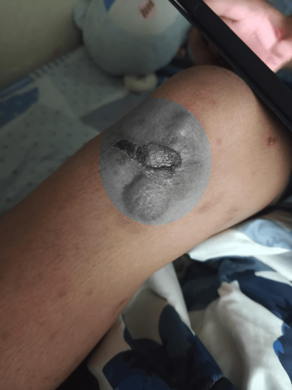 男童的脚、颈及背均有受伤。Threads@dvpp_1998图片