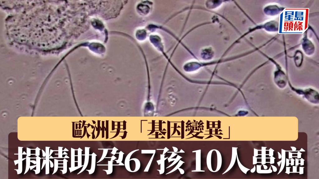 歐洲一名捐精男子被指「基因變異」，10名受助孕的孩子患癌。路透社