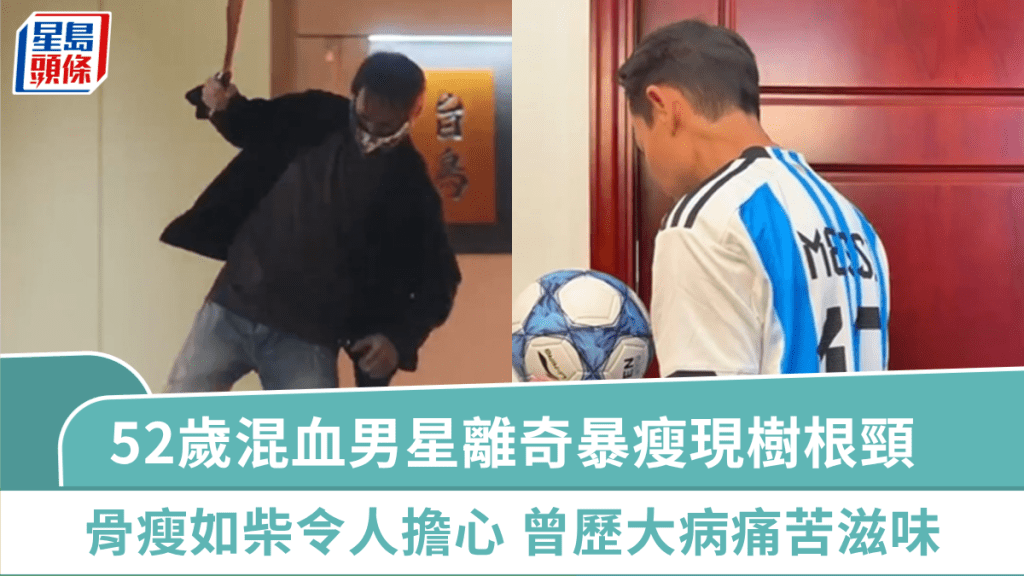 52歲混血男星離奇暴瘦現樹根頸 骨瘦如柴健康狀況令人擔心 試過大病經歷痛苦滋味:活着就好