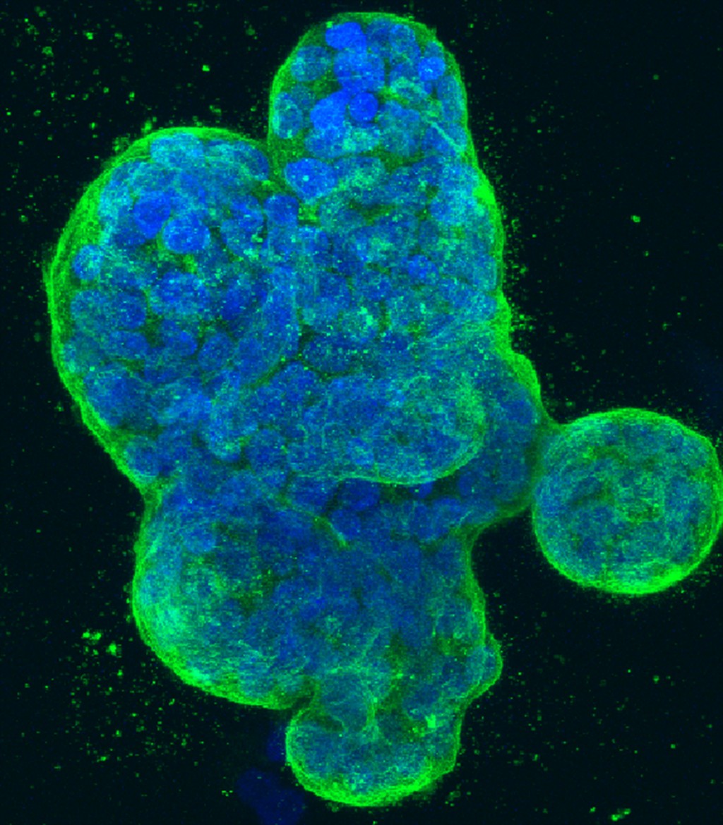 美國國立衛生研究院提供的乳癌細胞3D圖像，藍色的是DNA，綠色是細胞表面的一種蛋白質。 美聯社