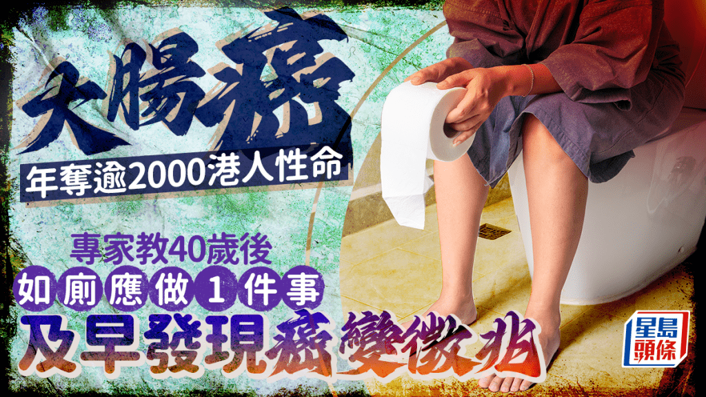 大腸癌位列本港致命癌症第2位!專家教40歲後如廁應做1件事預防 4大廁所設備恐致錯過治療時機