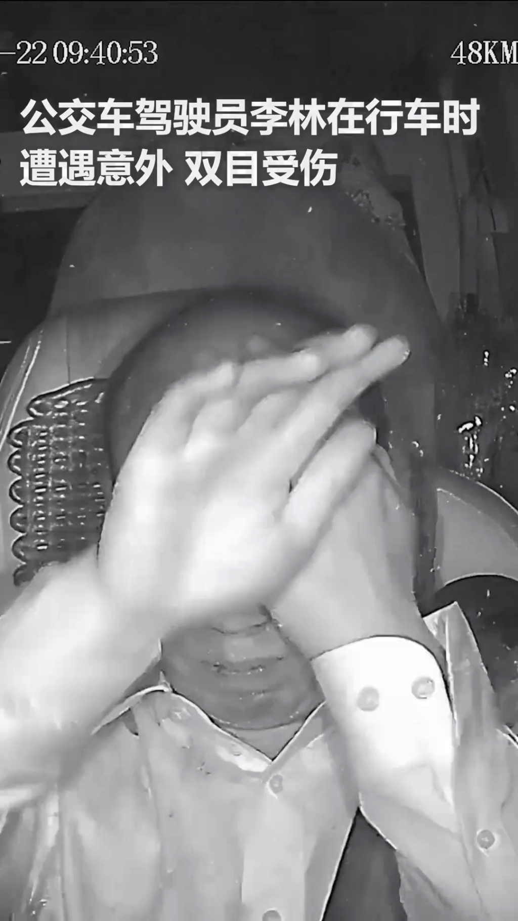 巴士司機李林雙眼被玻璃碎片刺傷雙眼。