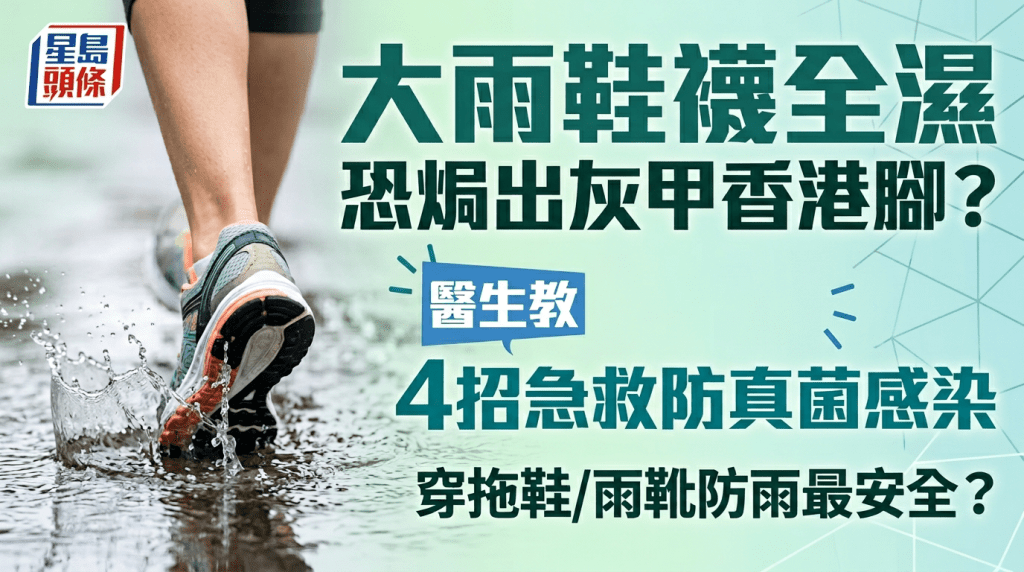 大雨鞋襪全濕焗住恐惹灰甲香港腳？著拖鞋/水鞋最安全？醫生教4招急救防真菌感染