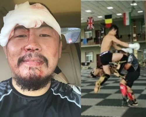 格鬥狂人徐曉冬被飛膝爆頭。(網圖)