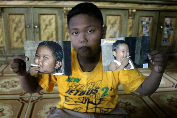 印尼2歲男童曾因「每天抽40支煙」爆紅，14年後現況曝光。 X平台