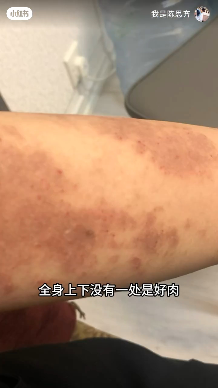 陳思齊身體曾出現重大問題。