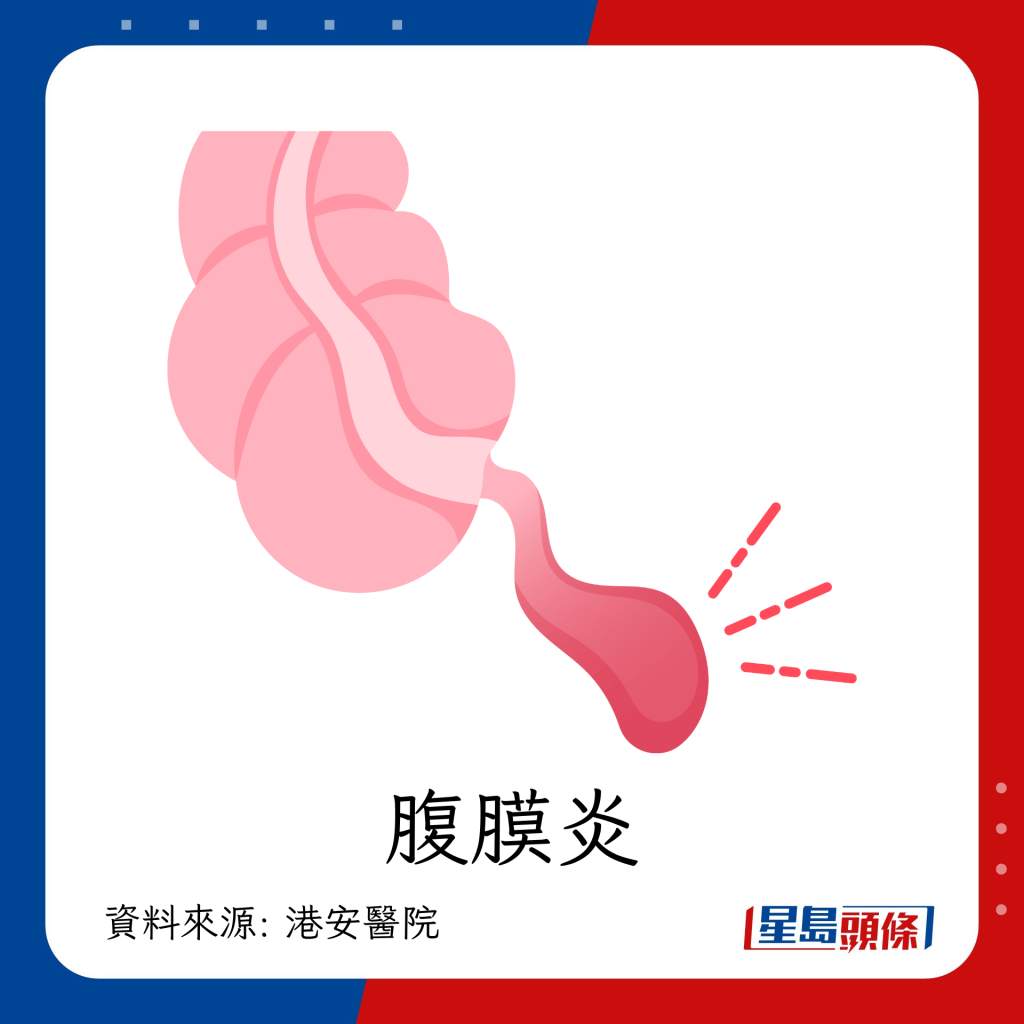 胰脏炎严重后果：腹膜炎