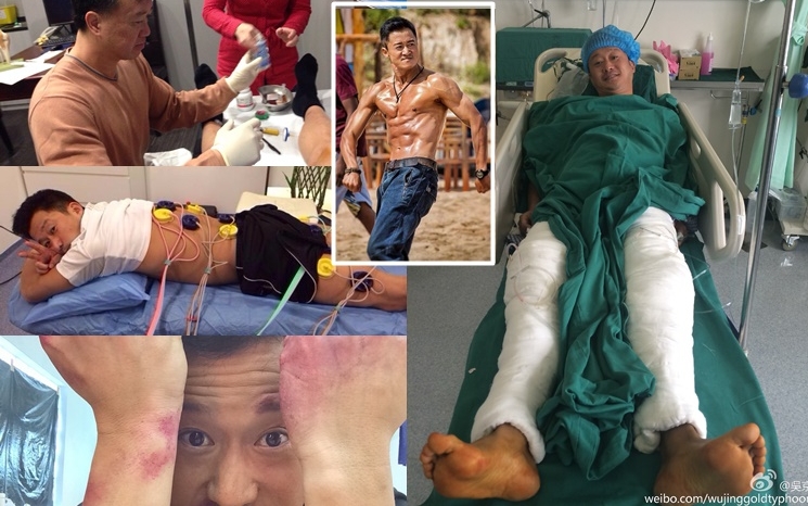 吳京身經百戰，拍戲受傷是常事。