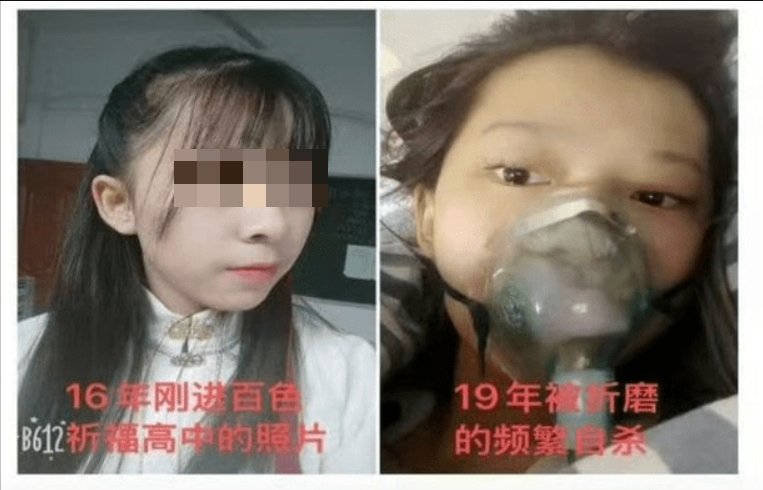 被淫師性侵後,少女頻繁自殺。 被淫師性侵後,少女頻繁自殺。