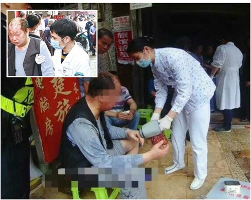 伤者主要是头部、手部、腿部被烧伤。