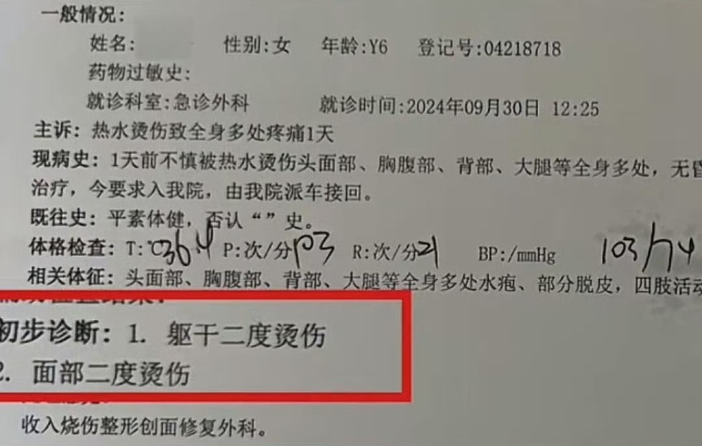 早前，一名6岁女童被高年级男生泼热水，导致烫伤住院。（微博）