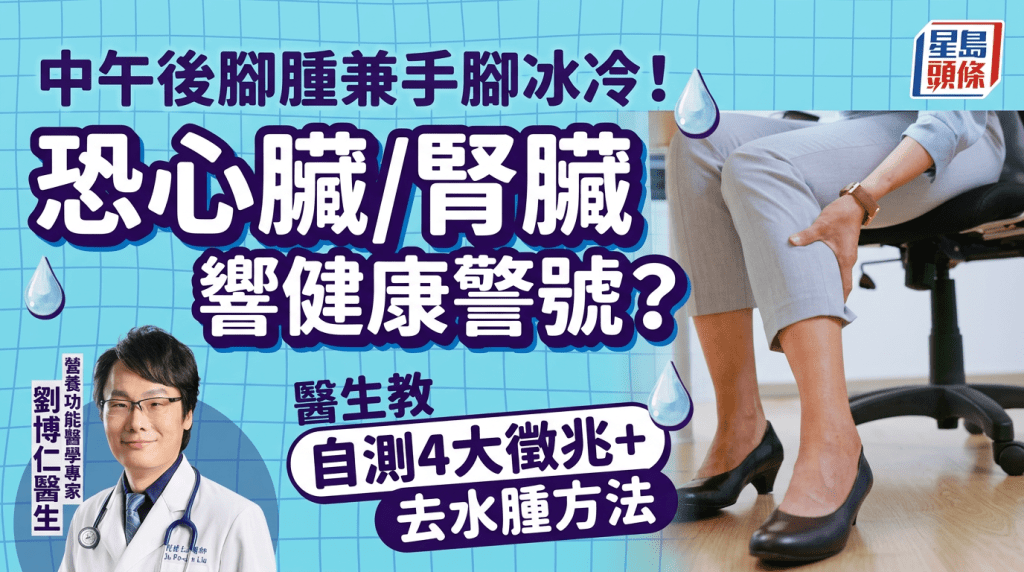 中午後腳腫兼手腳冰冷！恐心臟/腎臟響健康警號？醫生教自測4大徵兆 附3大去水腫方法