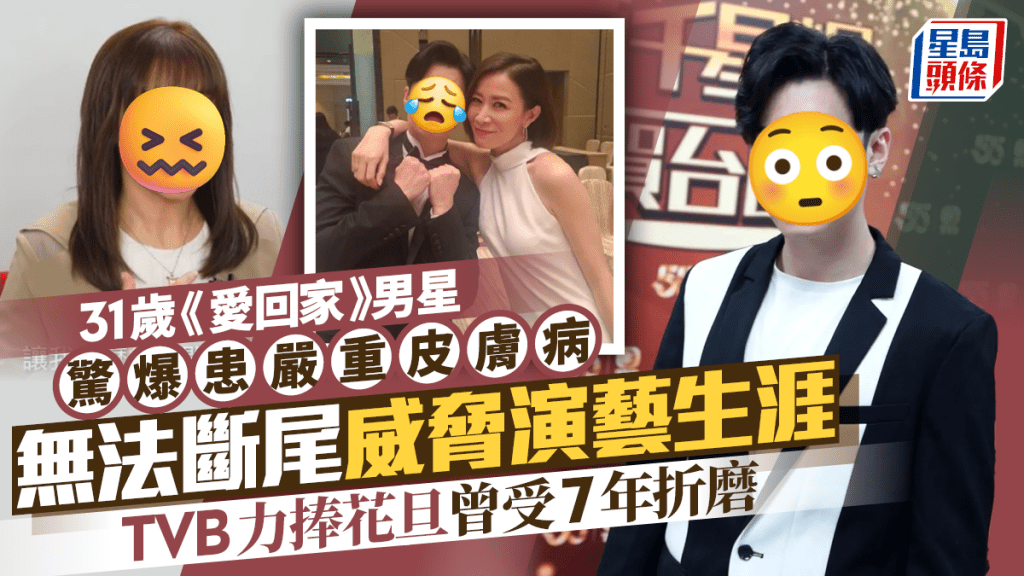 31歲《愛回家》男星驚爆患嚴重皮膚病  無法斷尾威脅演藝生涯  TVB力捧花旦曾受7年折磨