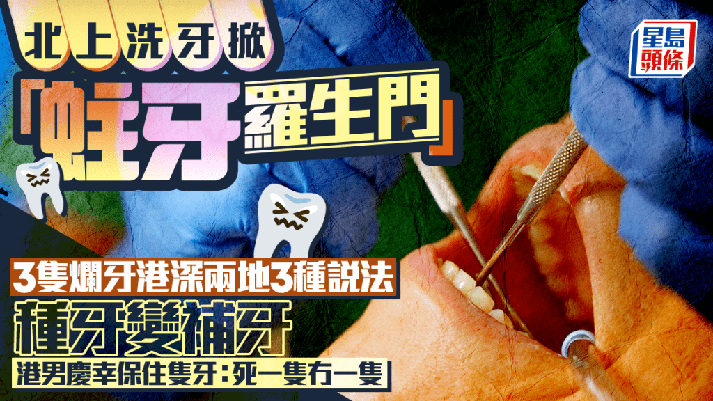 北上洗牙掀「蛀牙羅生門」 3隻蛀牙港深兩地3種說法 種牙變補牙 港男慶幸保住隻牙｜Juicy叮
