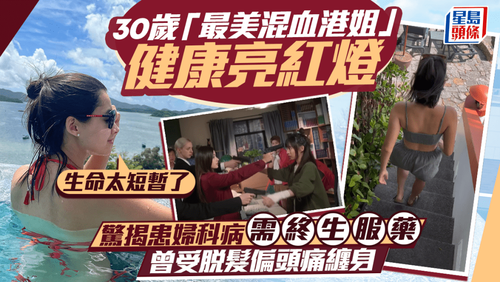 「最美混血港姐」惊揭患妇科病需终生服药  脱发偏头痛缠身体会要爱护身体：生命太短暂了
